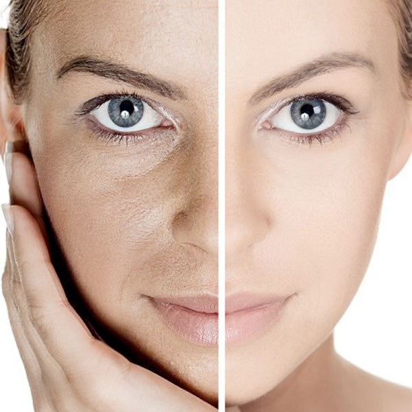 Revierte El ENVEJECIMIENTO Con La Terapia Celular