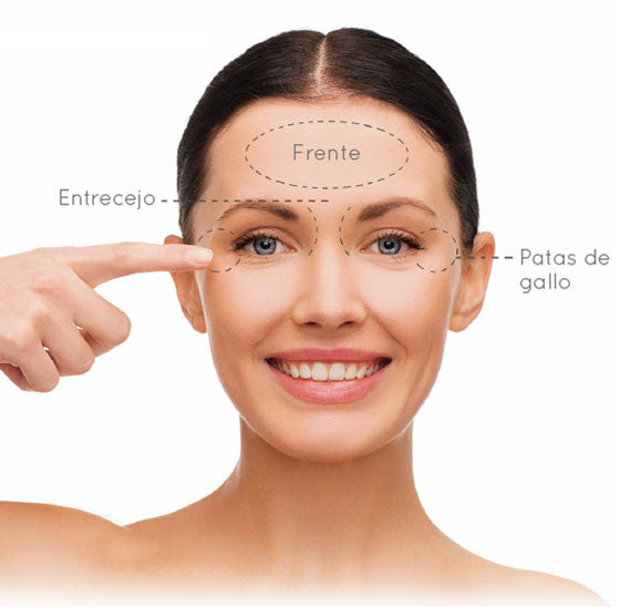 La solución definitiva para las líneas de expresión