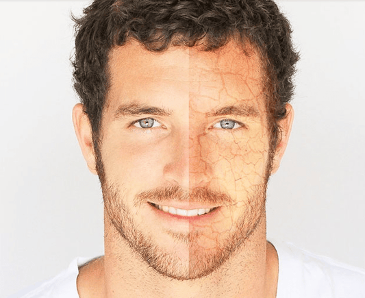 La Deshidratación de la Piel Masculina - Fortoul Online